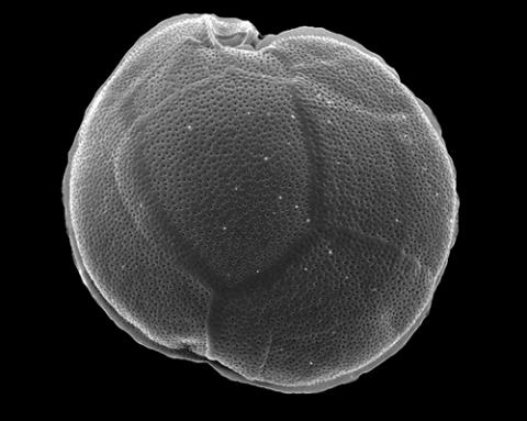 Gambierdiscus micro-algae produce toxins that can accumulate in higher apex tropical reef predator species. Photo: UTS